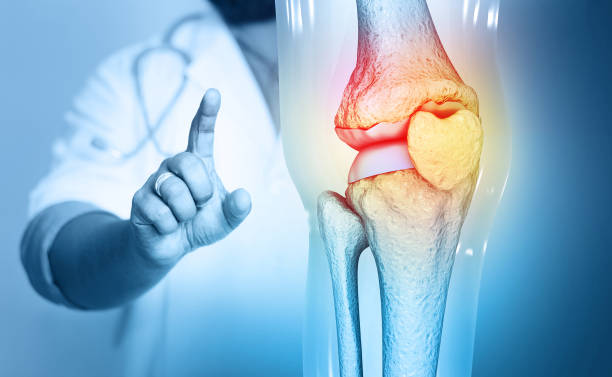 Joint-Friendly Home Workouts for Bad Knees